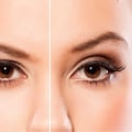 Understanding Brow Symmetry: The Anatomy Behind the Non Surgical Lift