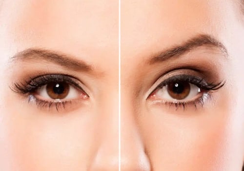 Understanding Brow Symmetry: The Anatomy Behind the Non Surgical Lift